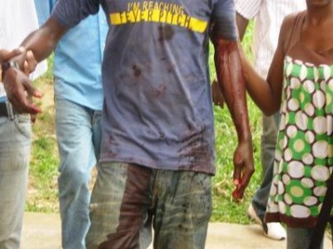 Studente ferito all'Università Omar Bongo nella capitale gabonese Libreville. Foto di Camarade su Le Post.