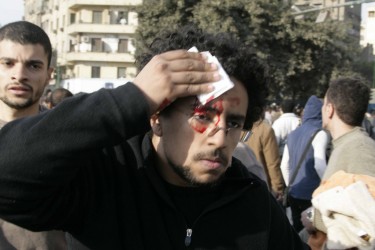 Egipatski bloger @BooDy pokriva maramicom rane. Fotografisao Nasser Nouri, pod Creative Commons licencom
