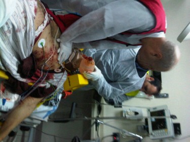 Bird Shotgun wounds are visible on wounded man being treated at Salmaniya Hosptial