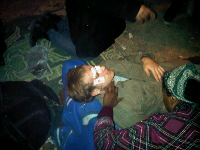 On Twitter, Gigi Ibrahim shares this photograph of an injured foreigner in the protests