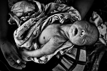 Morte por partos no Paraguai