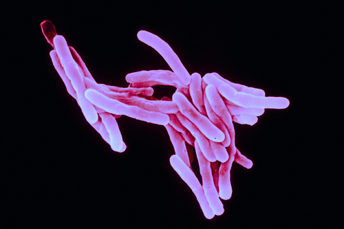 Electron microscope image of mycobacterium tuberculosis, responsible for tuberculosis. Image by Flickr user Sanofi Pasteur (CC BY-NC-ND).