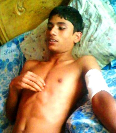 Bappy, a student of class seven, injured by attackers. Image by Arif Hossain Sayeed.