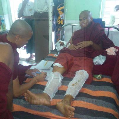 A monk hospitalized with burn injuries. Photo from CJ Myanmar Facebook Page.