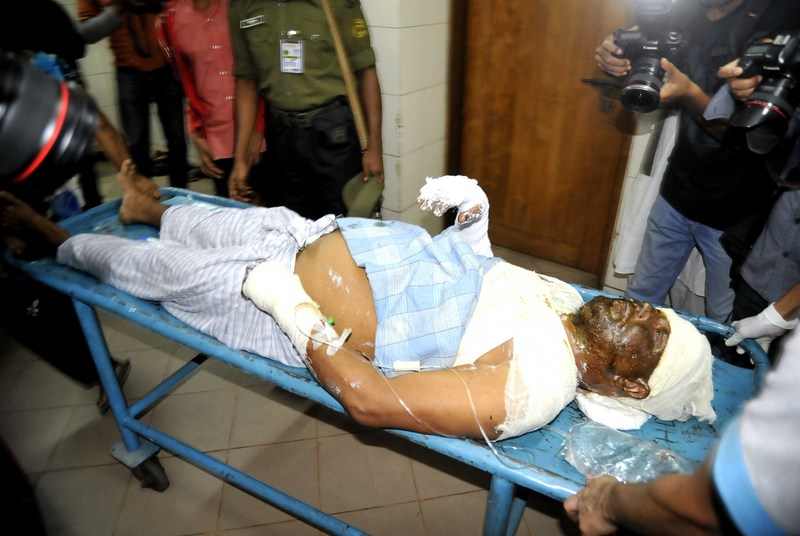 A patient being taken for treatment at the Dhaka Medical College who sustained burn injuries after an unidentified attacker threw a petrol bomb inside a moving bus in Dhaka. Image by Naveed Ishtyak. Copyright Demotix (28/11/2013)