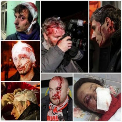 An anonymous collage circulated online. Majority of people pictured are journalists beaten by the police or "unidentified" perpetrators. 