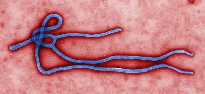 Ebola virus virion via wikimedia Commons - Public Health Image Library, #10816- public domain 