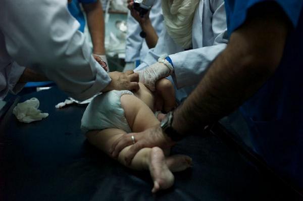アル・シファ病院バセル・アブワード医師の皮肉なツイート。「6か月の幼児テロリストの背中から、医師たちが爆弾の破片を取り除く」