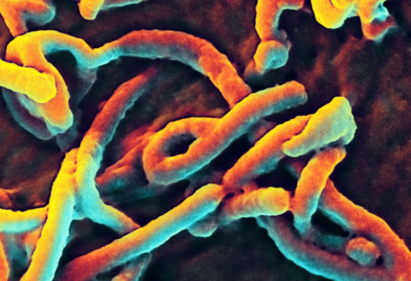 Ebola virus under an electron microscope. Photo by Flickr user NIAID. CC BY 2.0