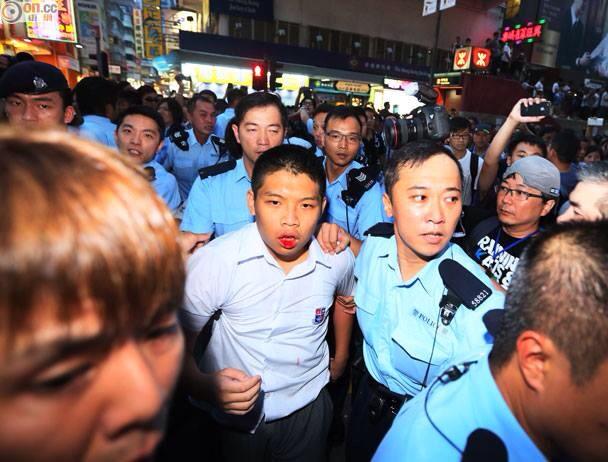 Středoškolský student ve školní uniformě byl napaden rváči v oblasti Mongkok. Fotografie z Facebooku, uživatel Dereck Eu.