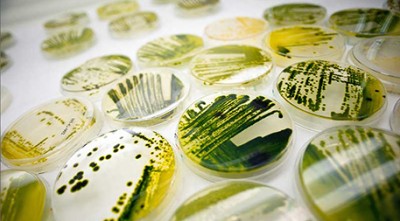 Microalgae cultivated by California-based Solazyme show promise as a source of palm oil substitutes. Photo courtesy of Solazyme.
